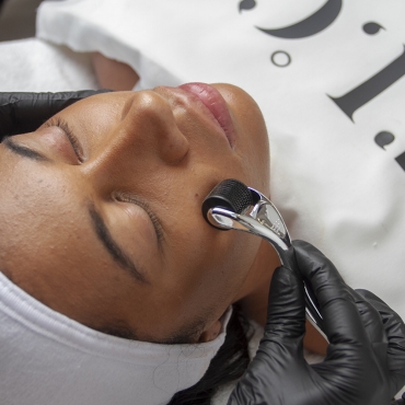 5 things you need to know about Microneedling!